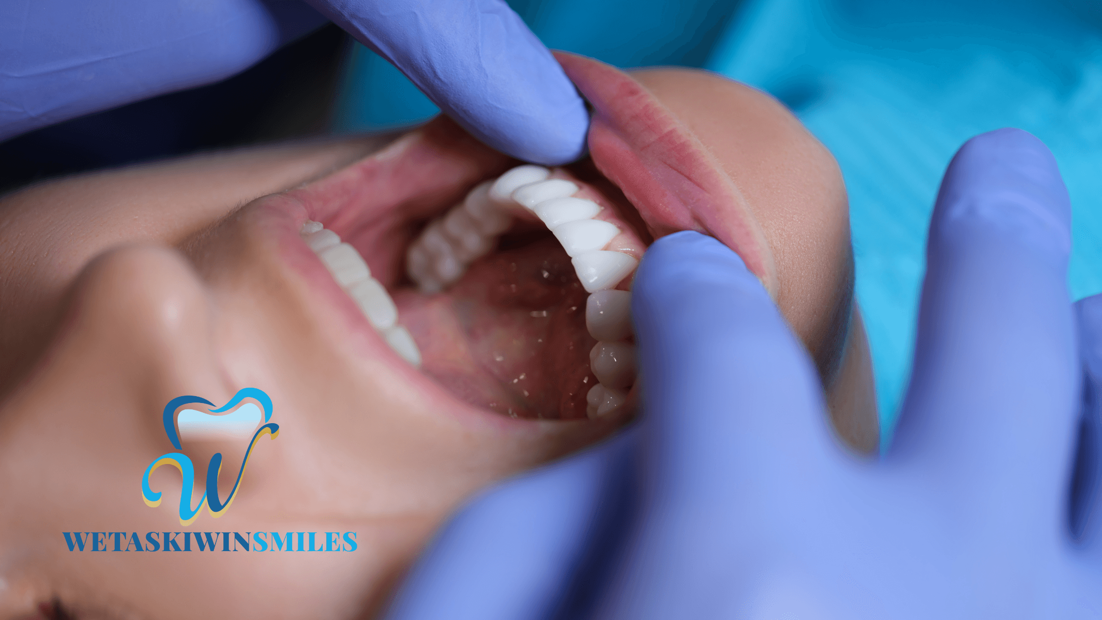 Common Symptoms That Indicate You Need a Dental Crown