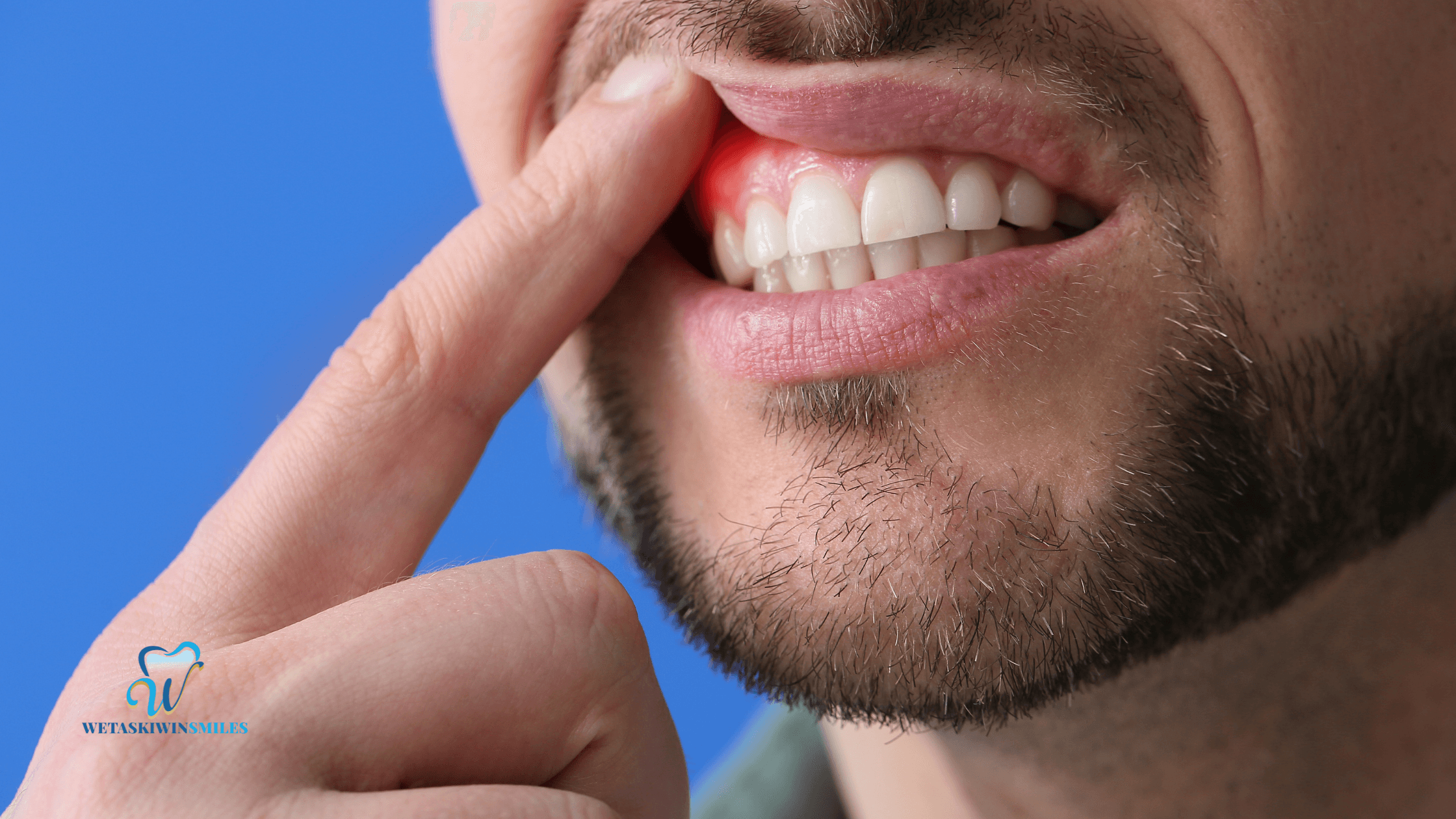What is Cosmetic Gum Contouring and Who Needs It