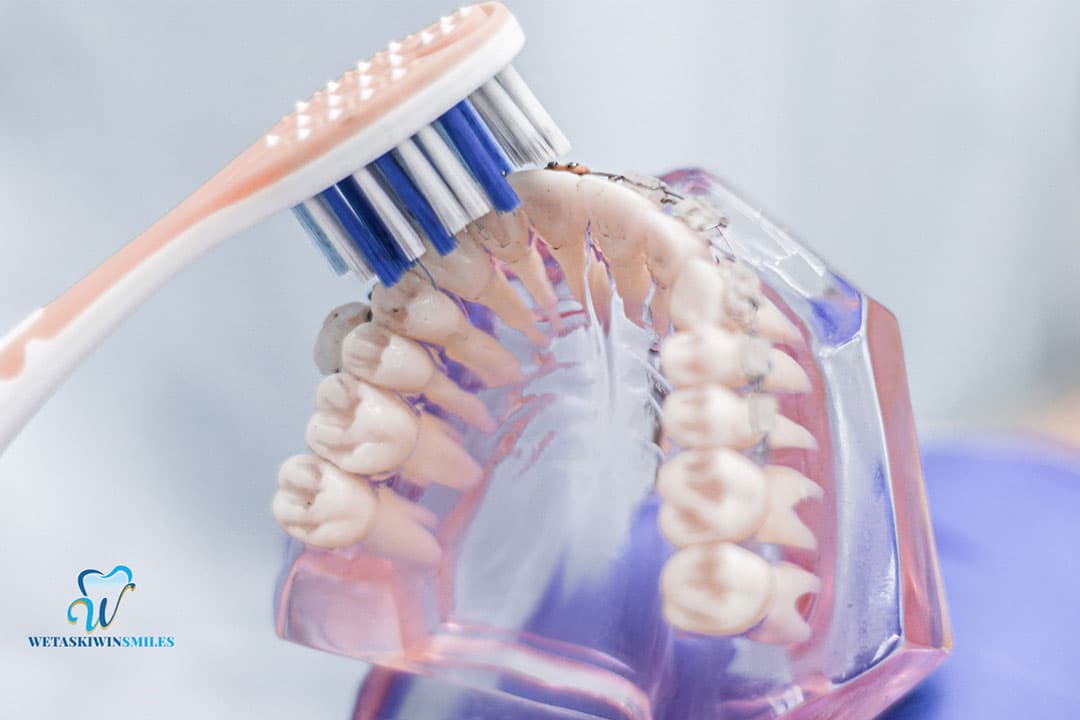 The Role of Preventive Care in Family and General Dentistry