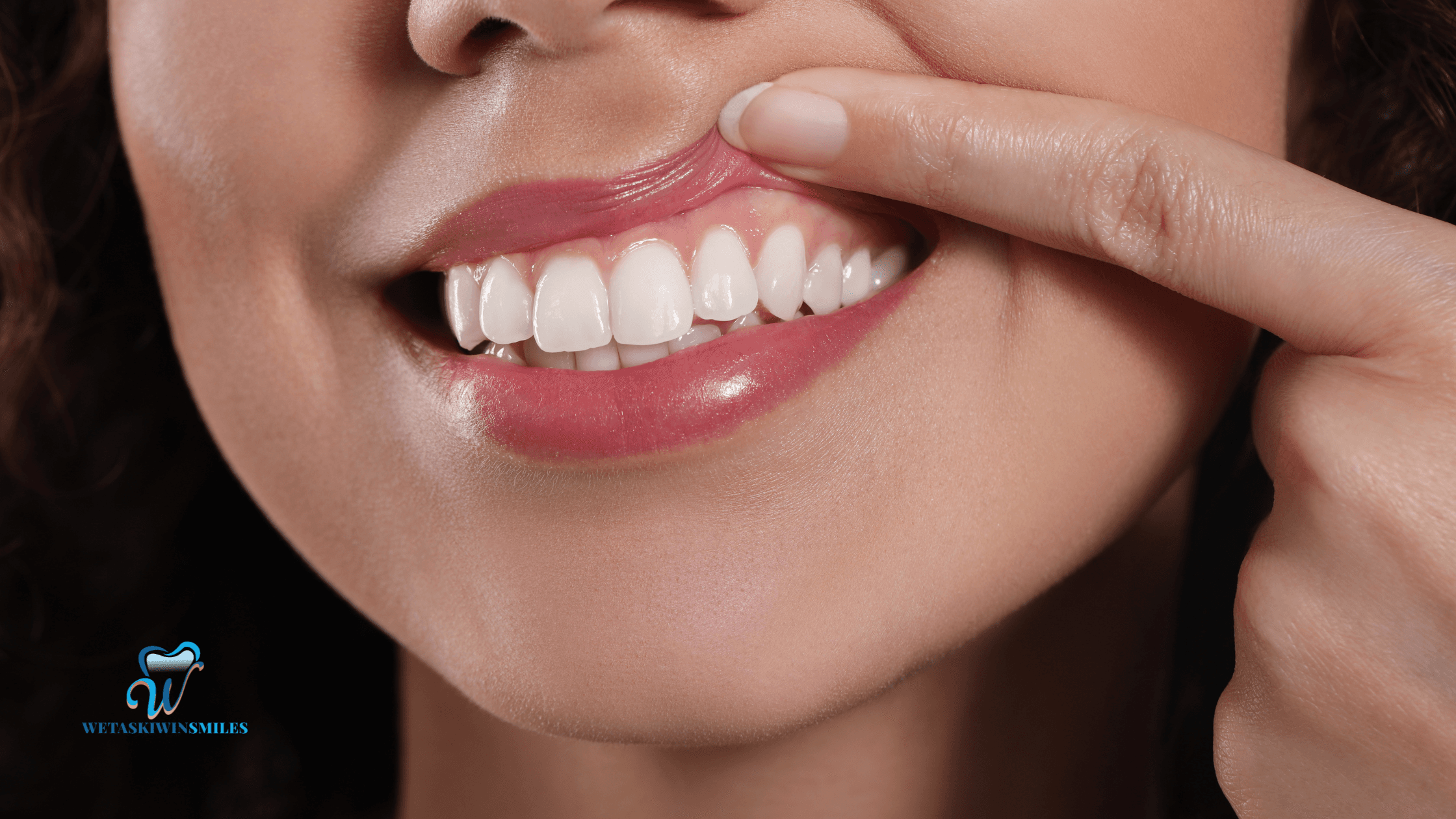 The Benefits of Gum Contouring for a Balanced Smile