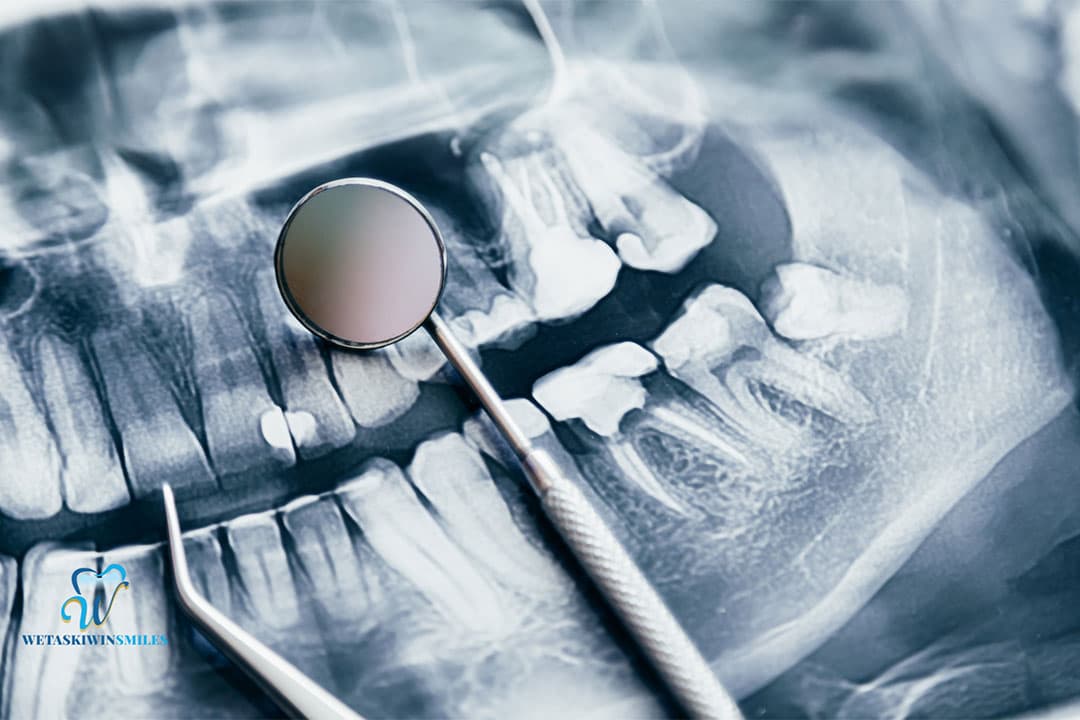 Common Dental Issues Addressed in Family and General Dentistry